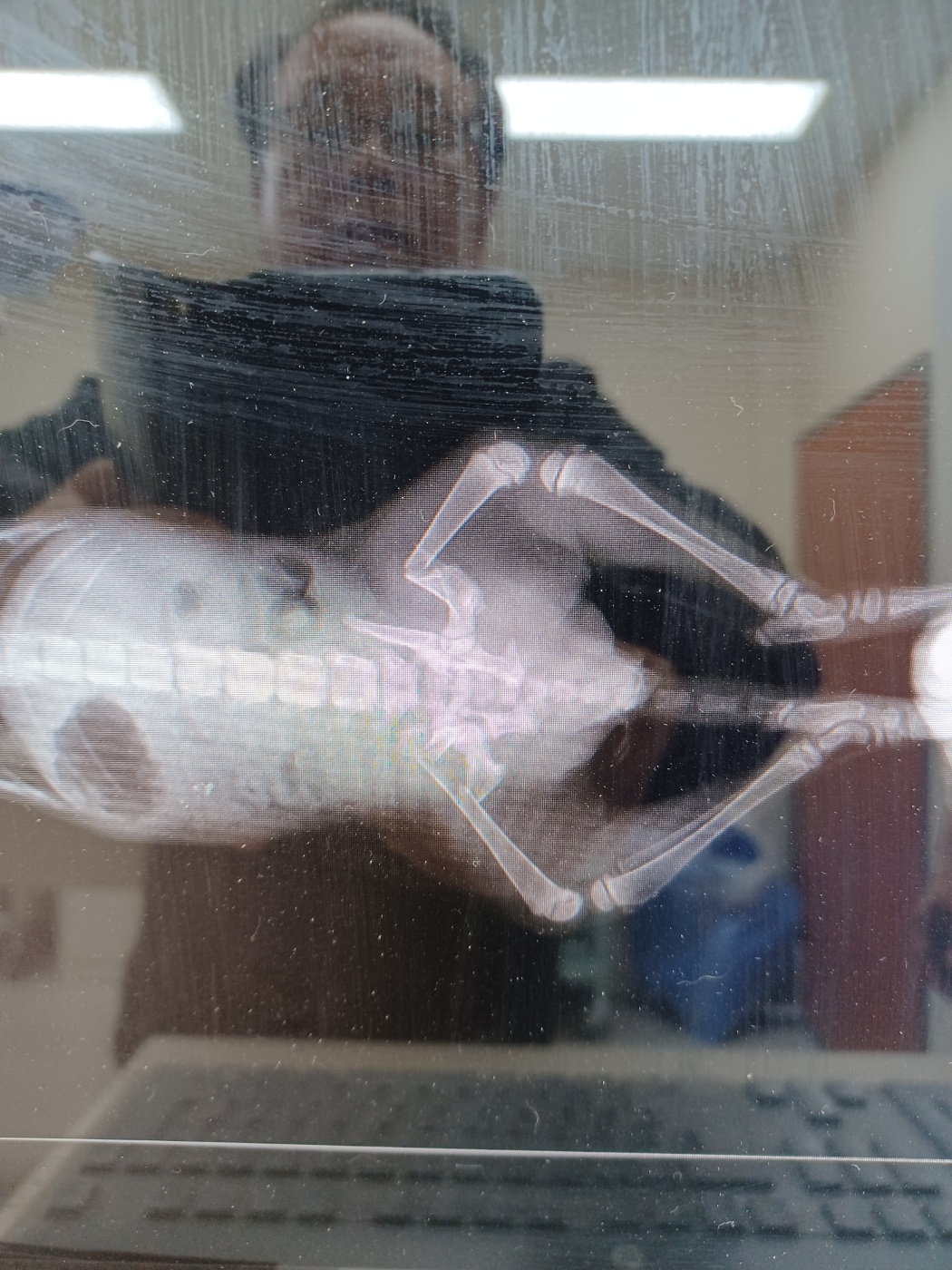 종료(자연사) 한국…